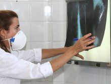 Campanha intensifica busca ativa a novos casos de tuberculose